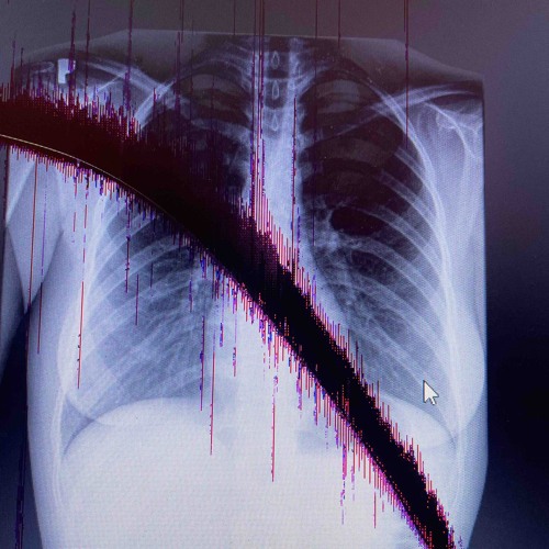 Cover artwork for PR SAD Plugged In broken edit.
